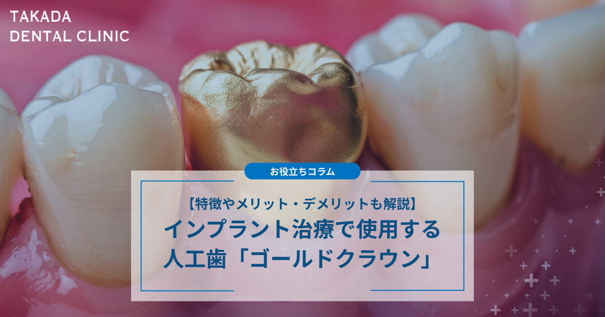 インプラント治療で使用する人工歯「ゴールドクラウン」とは