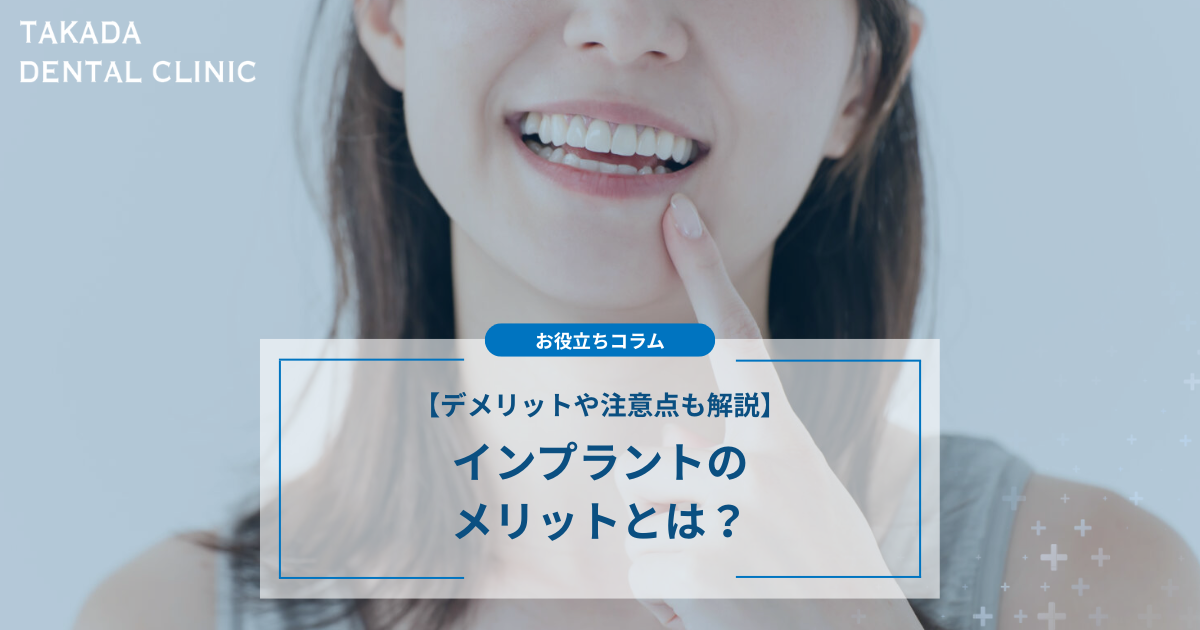 インプラントのメリットとは？デメリットや注意点も合わせて解説