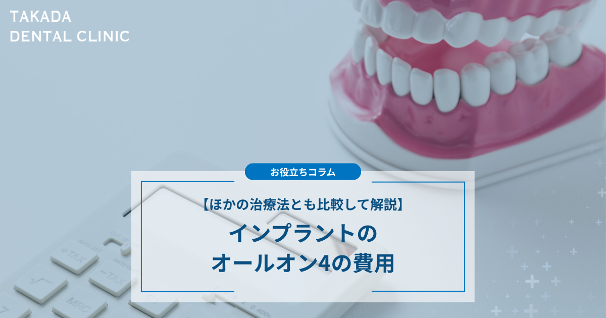 【インプラントのオールオン4の費用】ほかの治療法とも比較して解説