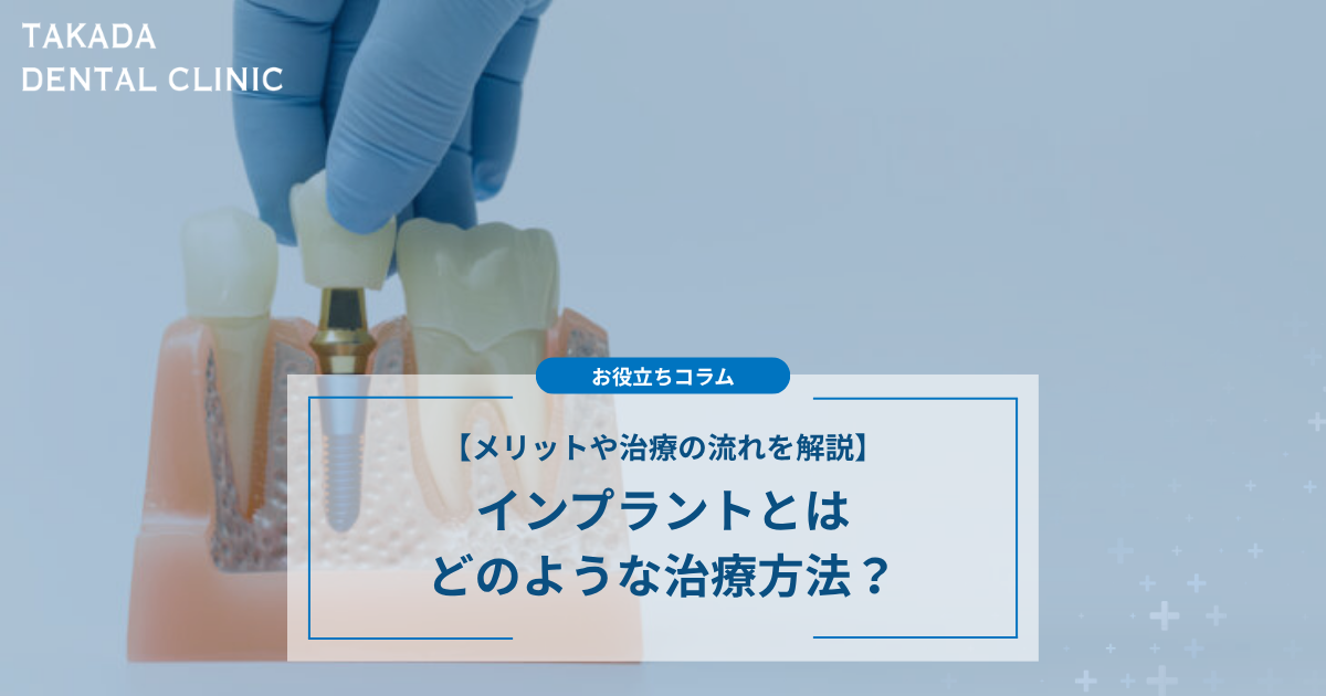 インプラントとはどのような治療方法？メリットや治療の流れを解説